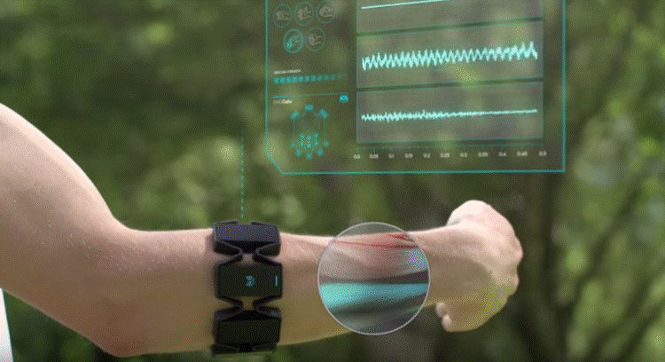 可穿戴手语识别系统